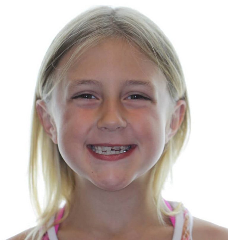 Smile Gallery Doyle Orthodontics