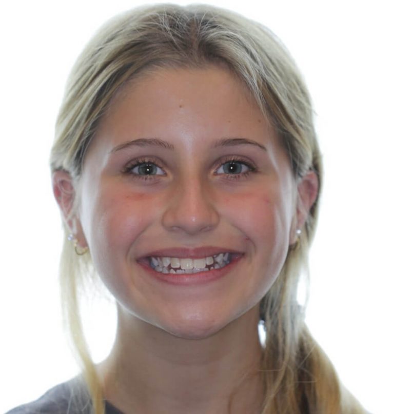 Smile Gallery Doyle Orthodontics